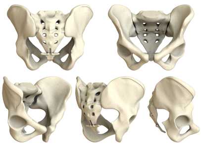 Sacroiliac Joint Injections