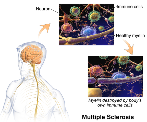 Putting on My Neuro “Brain”