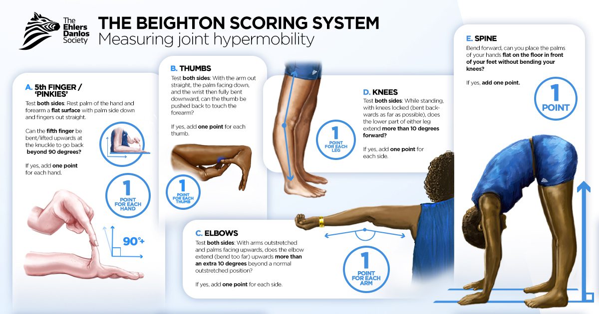 banner Beighton score infographic landscape 1