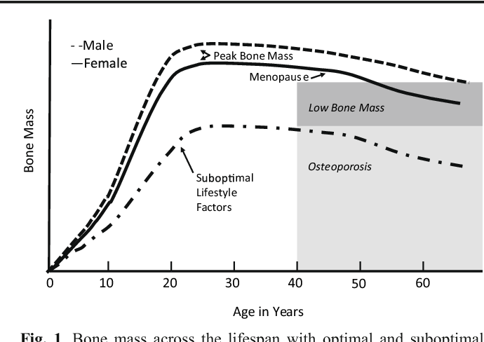 Osteoporosis is a Pediatric Disease