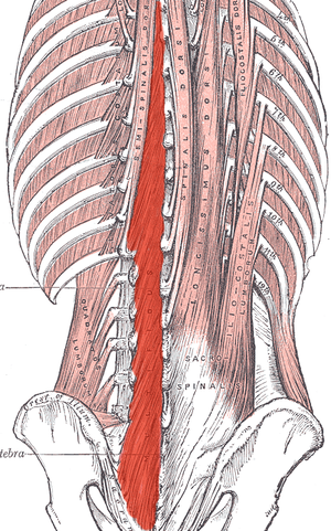 The Dilemma of the Multifidus