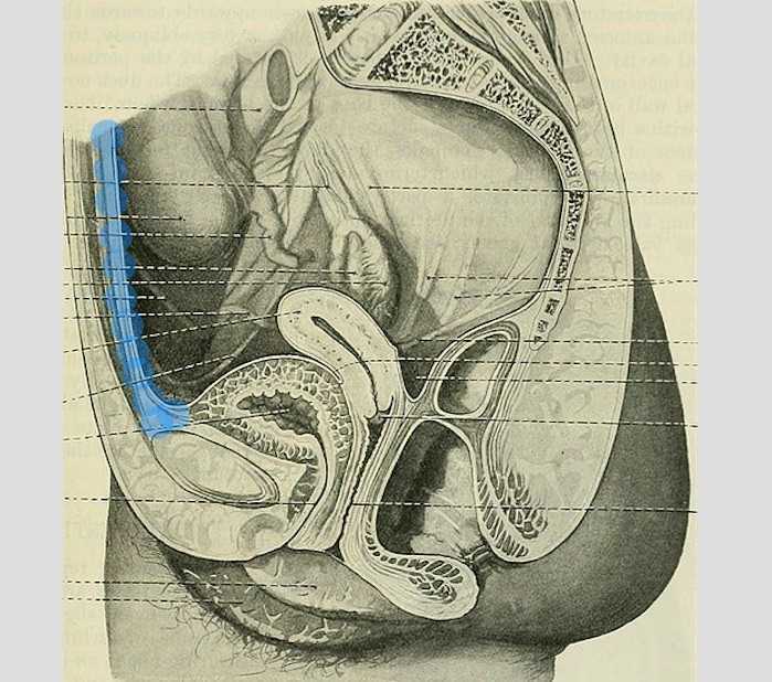 Urachus Ligament Dysfunction and Clinical Presentations