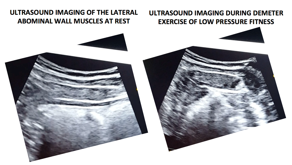 Ultrasound imaging at rest and during the complete LPF technique