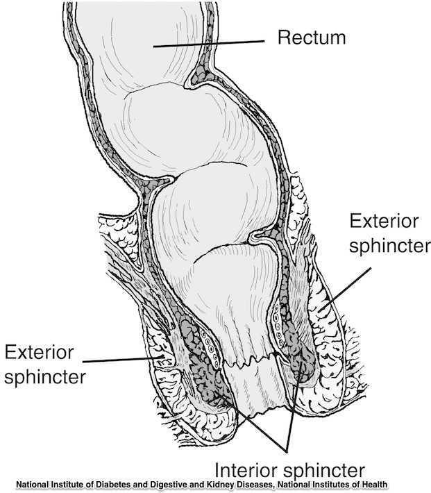 Rectal Prolapse: The Basics